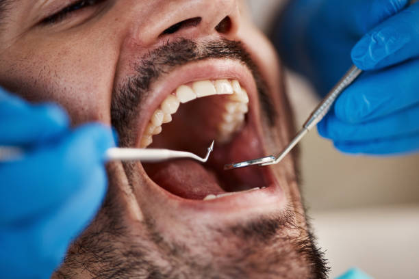 Best Emergency Treatment for Dental Infections or Abscesses in Lyons, CO